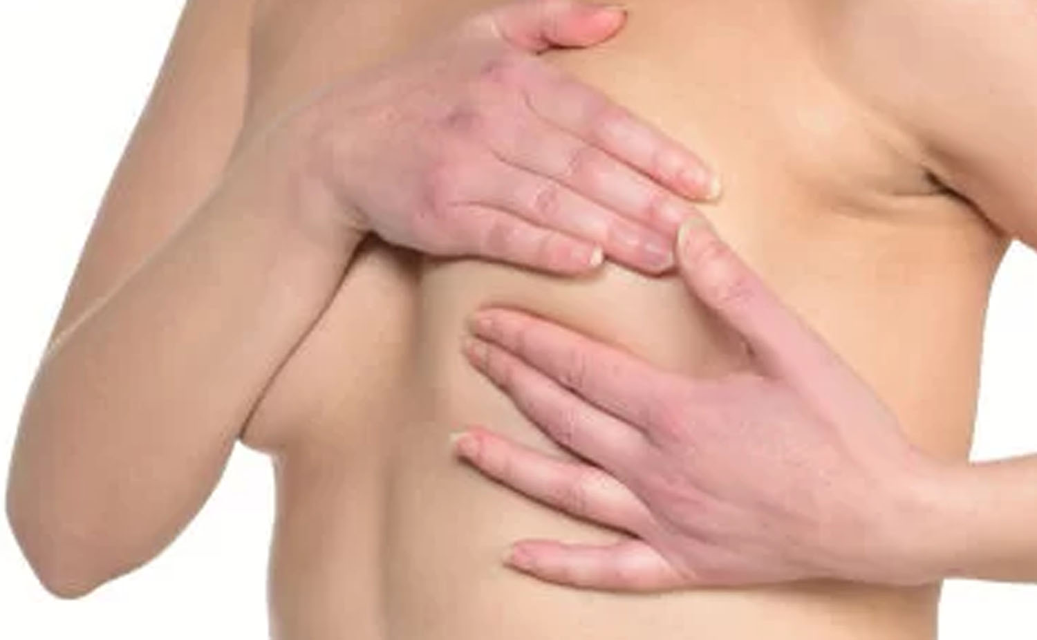 Nipple areola reduction Nipple areola reduction
