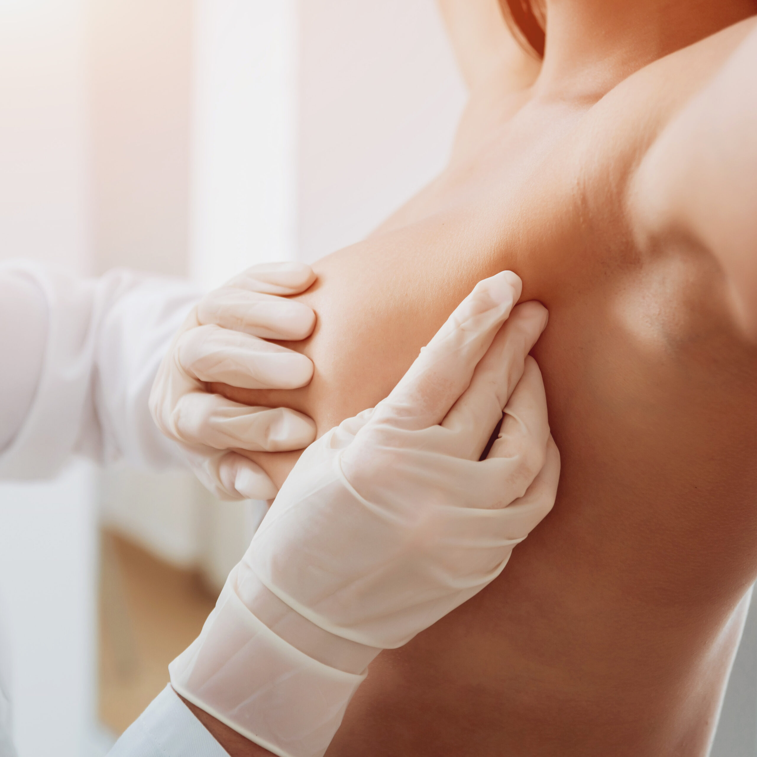 Breast Lift Surgery Consultation in Newcastle