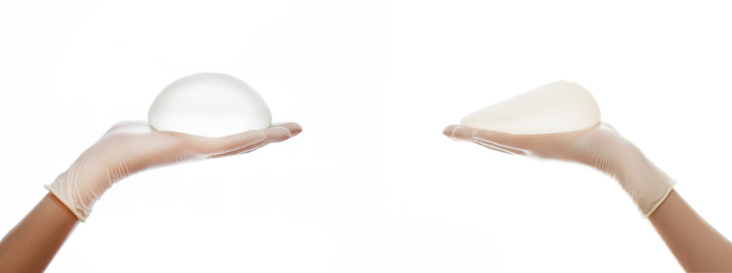 Breast implant options with Mr Pieri