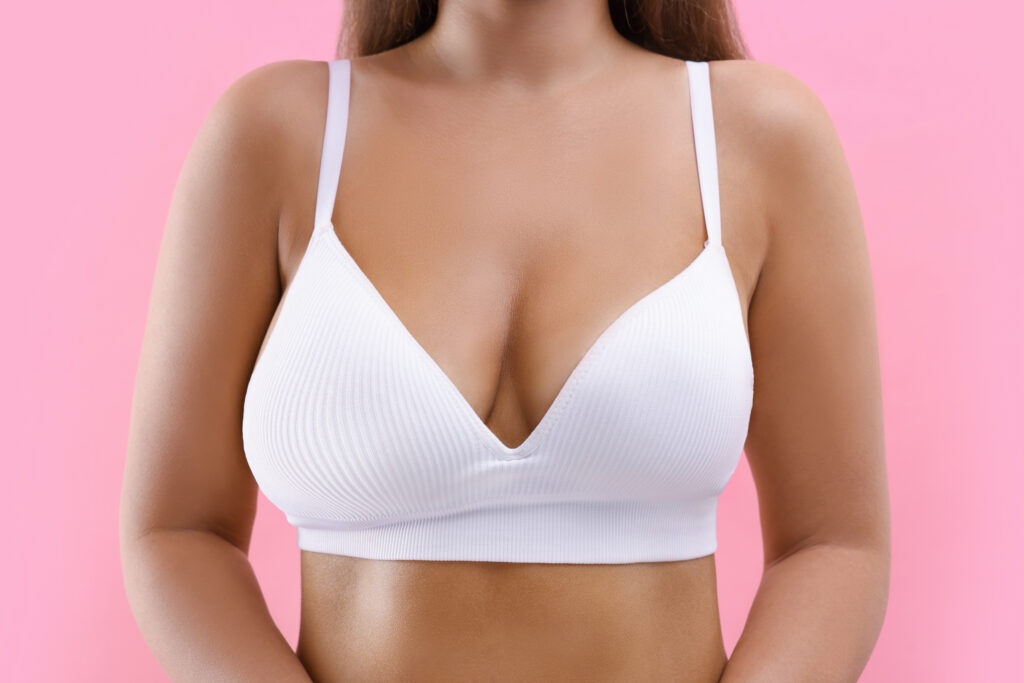 Woman with breast asymmetry in white bra